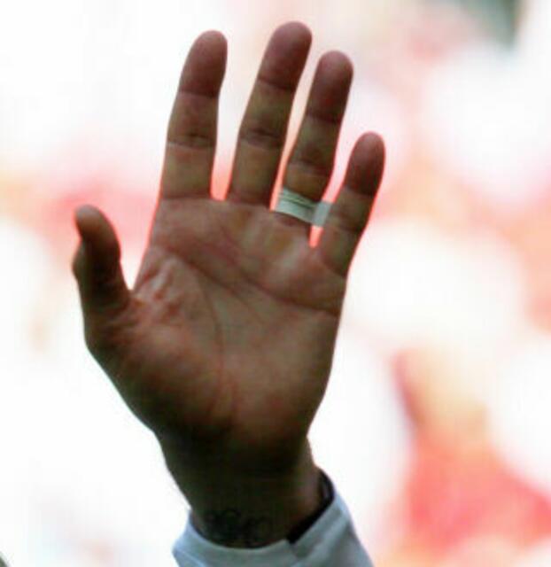 Manchmal muss man die Hand heben...