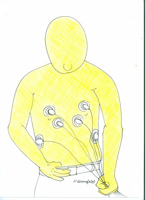 EKG