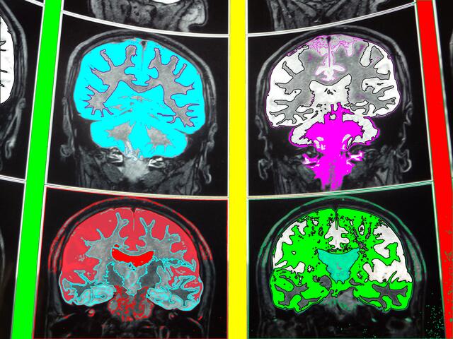 "Gehirn-MRT-Fahrten - nicht von Neuro-Ästhetikern!" Selbstbespiegelungs- Malerei der ARS EVOLUTORIA.