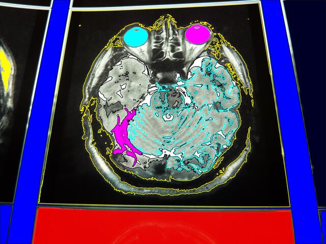 MRT-Selbstbespiegelung (a&s-Bild): Aufforderung an die Neuro-Ästhetik zu handeln - "Nagelprobe" (...) - W.H. 13/4/10.