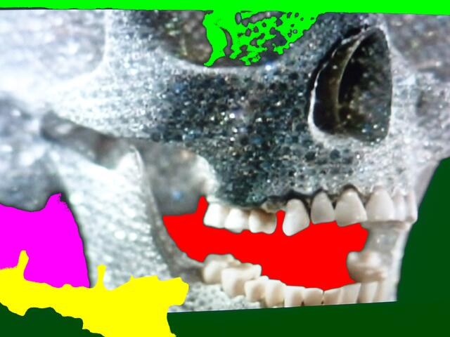 a&s-Mutante zu HIRSTs Diamantenschädel.