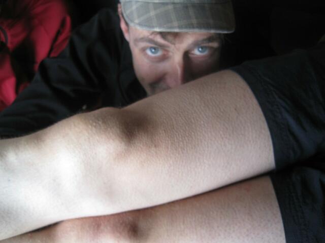 Gänsehaut - die Temperatur sank mit dem Regen.