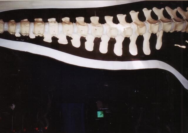 Rückansicht, aufgeschnitten, damit man auch die Wirbelsäule sieht