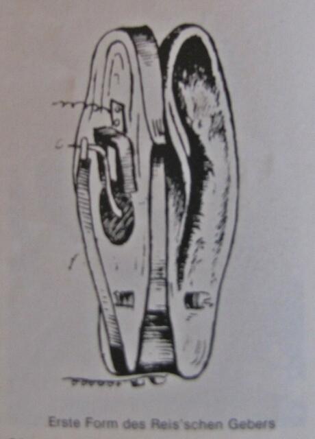 Der erste von Johann Philipp Reis entwickelte Tongeber.