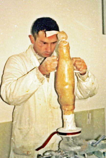eine Prothese wird laminiert