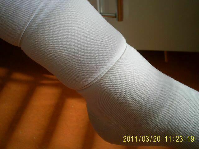 Ein Thrombosestrumpf sollte die Blutzirkulation unterstützten. Hier dürfte sie ja wohl eher unterbrochen sein. Recherchematerial aus Thüringen, 2011.