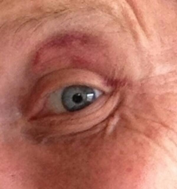 Kamen mit dem blauen Auge davon....