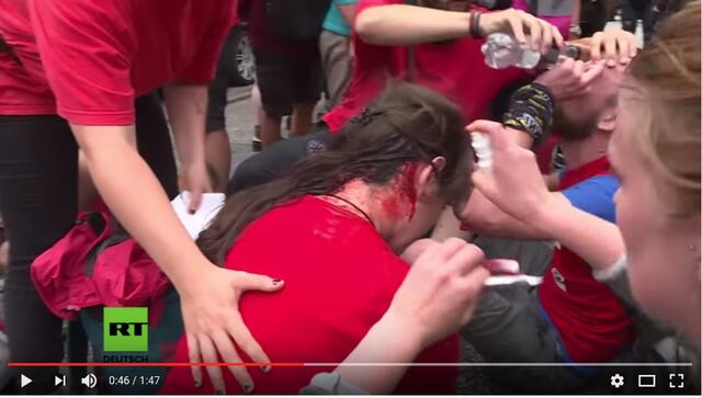 Gefährliche Kopfverletzungen durch Einsatz der Polizei-Knüppel während des G20. Zu behaupten, es gab keine Polizeigewalt ist eine üble Verdrehung der Tatsachen! -->
https://www.youtube.com/watch?v=rttV9JGd8ik&t=0m45s