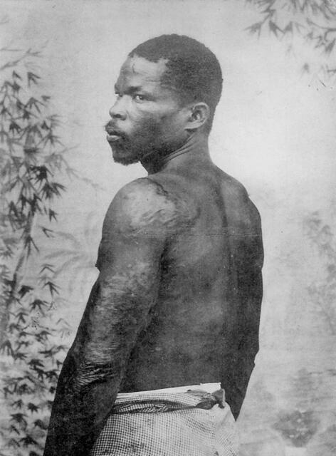 Martinique – Un survivant de St-Pierre, Leboullanger, éditeur, Fort-de-France: Deutlich erkennt man die Spuren, die die Gluthitze an Louis-Auguste Cyparis (1874-1929) hinterlassen hat. Pater Jules Mary (1851-1902) berichtete am 30. Juni 1902 über die außergewöhnliche Rettung: „Herr Gouverneur, um sofort auf Ihre Wünsche zu antworten, die Sie heute Morgen geäußert haben, habe ich die Ehre, die folgenden Notizen zu dem Gefangenen zu machen ...“ | Foto: Digitale Sammlung Blazek