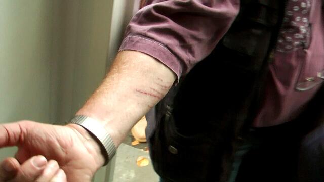 Uwe Freese zeigte seine Verletzung. Beim Leitung legen hatte Uwe sich verletzt. Wer helfen will, muss leiden - "The Passion Christi" is back und in Langenhorn.