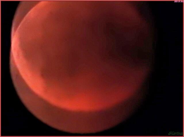 Mond 2018