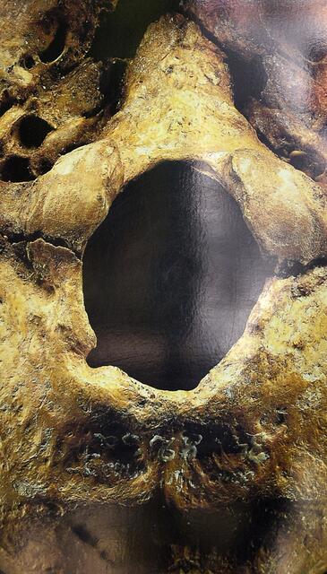 Hinterhauptloch, links